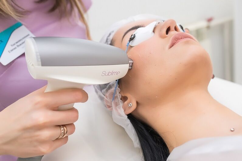 melakukan prosedur peremajaan kulit laser