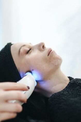 Laser peremajaan kulit muka